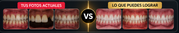 Tus fotos actuales vs lo que puedes lograr