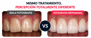 Errores comunes en fotografía dental