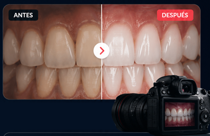 Antes y después fotografía dental profesional